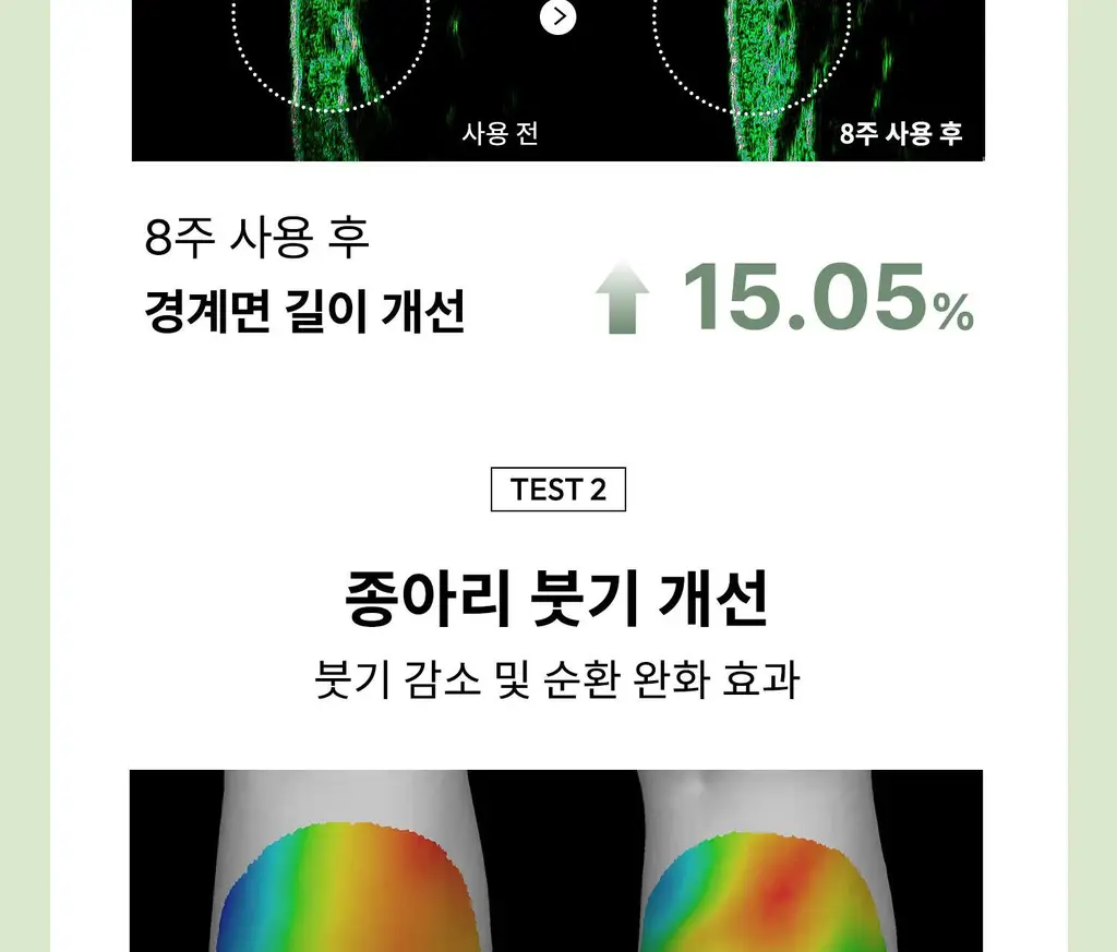 [탄력/목주름 개선] 힐그리즈 레티노이드 0.1% 퍼밍 바디 세럼 150ml 상세페이지 35